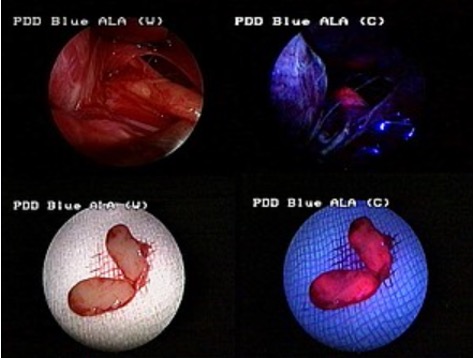 Vier Bilder unter verschiedenen Lichtbedingungen, zeigen Gewebeproben in rotem und blauem Licht mit Beschriftungen.