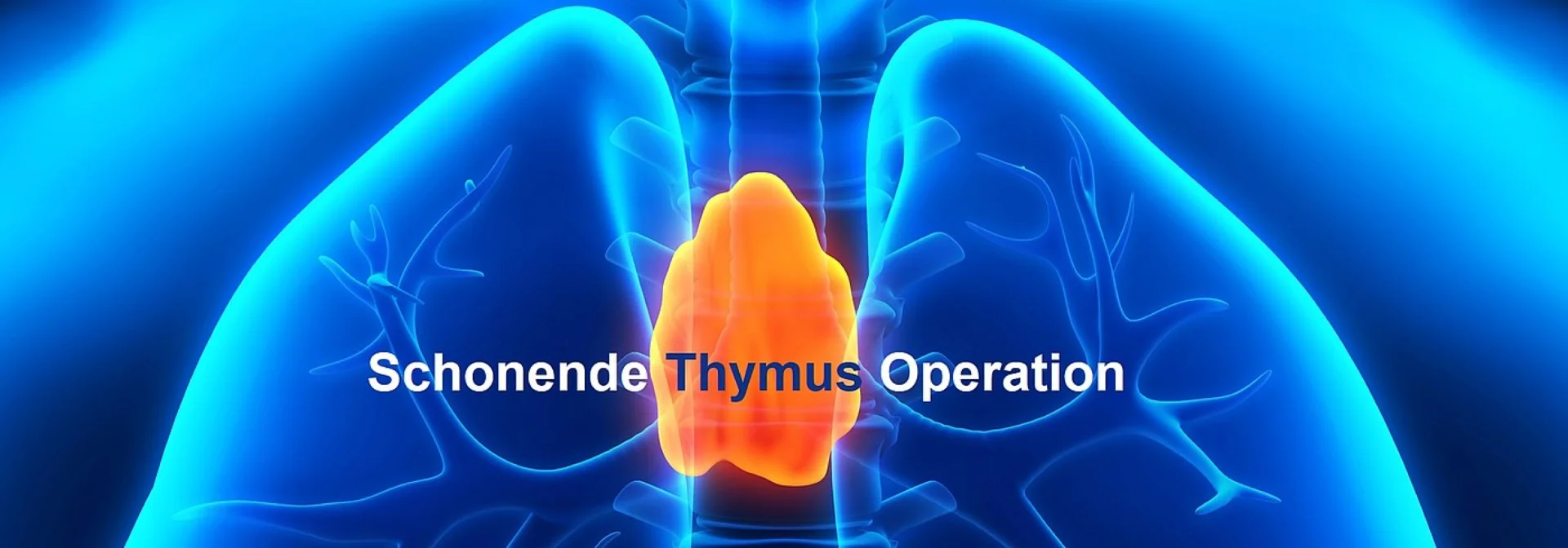 Schematische Darstellung eines menschlichen Brustkorbs mit hervorgehobenem Thymus und Text "Schonende Thymus Operation".